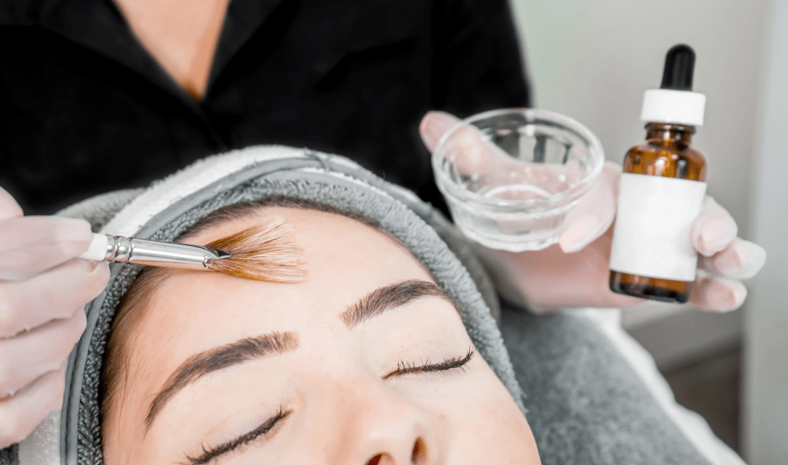 CHEMICAL PEEL